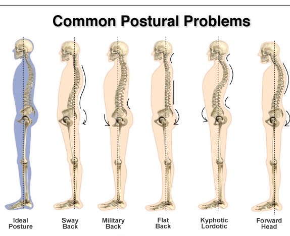 Back and posture Chiropractor Melbourne